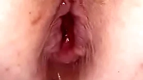 Anal rush off in my pain in the neck