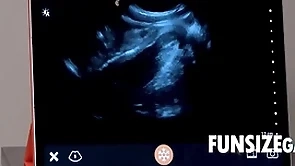 Ultra sound astuteness inspection - dr wolf, austin
