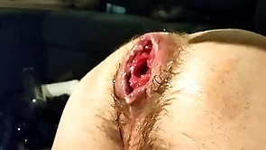 Just fisting my loose aperture and prolapse:)